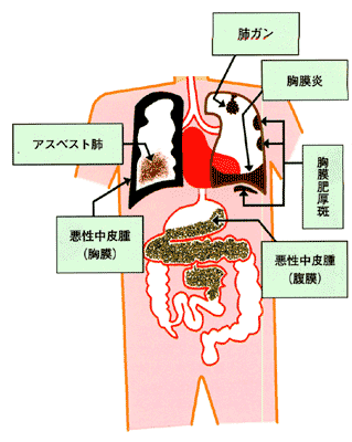 jintai.gif